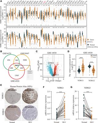 Clinical Diagnostic and Prognostic Potential of NDRG1 and NDRG2 in Hepatocellular Carcinoma Patients